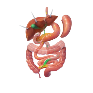 Duodenal Switch Graphic